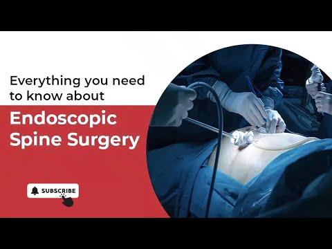 Endoscopic Spine Surgery Guide | Dr. Ajay Kothari