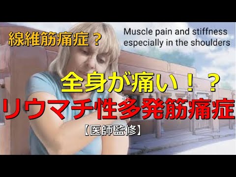 リウマチ性多発筋痛症
