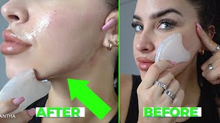 How To Get Rid of Acne Scars FAST [+ Glowing & Slimming Gua Sha Routine]