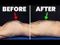 Fix Rib Flare FAST In Less Than 5 Minutes A Day