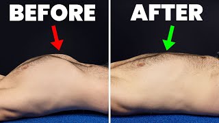 Fix Rib Flare FAST (In Less Than 5 Minutes a Day)