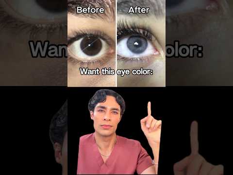 Change eye color?Start here! #changeeyecolor #beauty #eyecolor #blueeyes #youtube  #fyp #eyes#viral