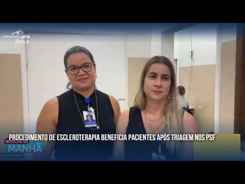 PROCEDIMENTO DE ESCLEROTERAPIA BENEFICIA PACIENTES APÓS TRIAGEM NOS PSF