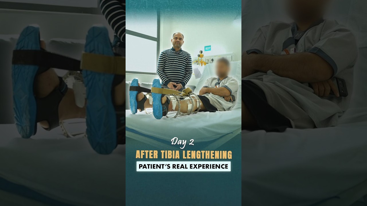 Day 2 After Tibia Limb Lengthening Surgery | Patient's Real Recovery Experience