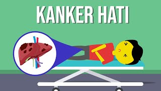 Download lagu Penyebab dan Gejala Kanker Hati! mp3