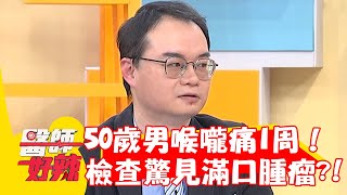 50歲男喉嚨痛1周！就醫檢查驚見滿口腫瘤？！【#醫師好辣】20230401 part2 EP1518 篠崎泫 魏智偉