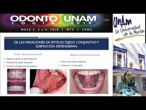 Early diagnosis of oral cancer with Dr. Adriana Molotla Fragoso