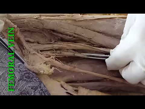 DISSECTION OF FRONT OF THIGH PART-2 BY DR MITESH DAVE