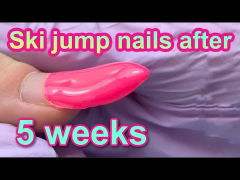 UPWARDS ↗️ Growing Nails After 5 WEEKS 😱 Express Fill with Gel & Inlay Design