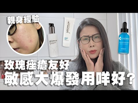 敏感肌急救! 🔥 獨門「三文治護膚法」撃退泛紅爛面 | CSS藍銅 / CS12 / Epionce | 黑咪