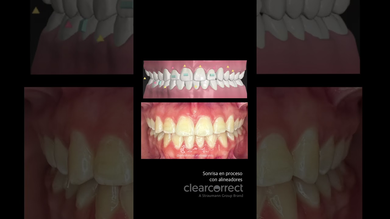 Catalina María Giraldo Guzmán-21