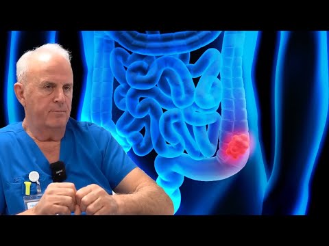 Çfarë është kanceri i zorrës së trashë! Flet mjeku Ilir Kajo! | Dritarja e Doktorit