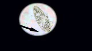 Death of a Paramecium.wmv