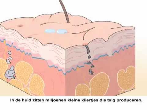 video Acne behandeling (PDT) thumbnail