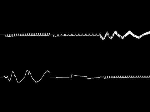 Masked Dedede Theme - Kirby Super Star Ultra [8-bit Remix]
