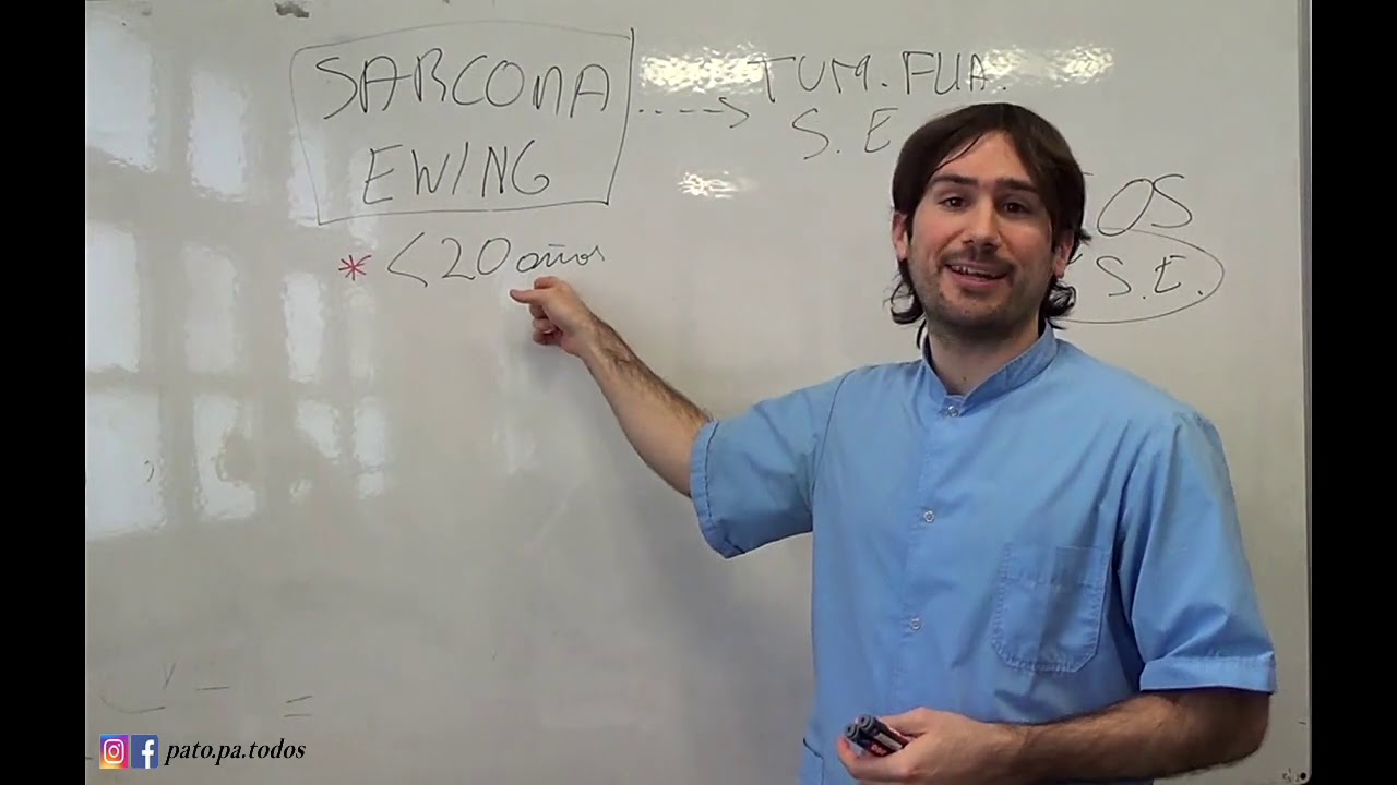 80 Sarcoma de Ewing
