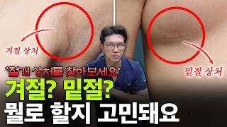 겨절? 밑절? 나에게 맞는 절개 부위는?ㅣ✨실제 절개 부위 경과 공개✨