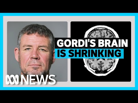 Inside the brain of a suspected CTE patient | ABC News