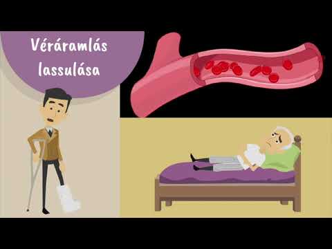 Femoropatellaris artrózis kezelés
