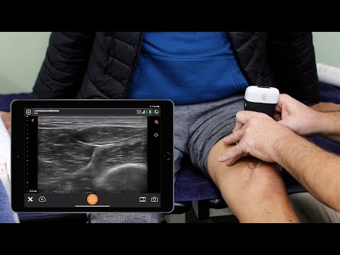 Ultrasound of the Knee