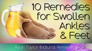 10 Home Remedies for: Swollen Feet and Ankles