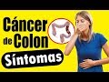 CÁNCER DE COLON: Causas Y Síntomas Y Como Prevenirlo (Colon Cancer Symptoms) | SALUDABLEMENTE TV