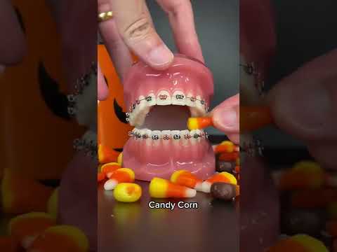 Halloween Candies You can Eat With Braces