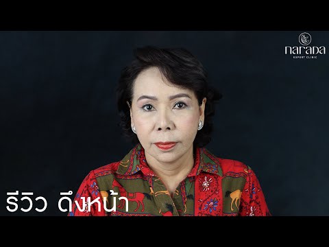 ผ่าตัดดึงหน้า แผลเล็ก เทคนิคซ่อนรอย By Narada Clinic