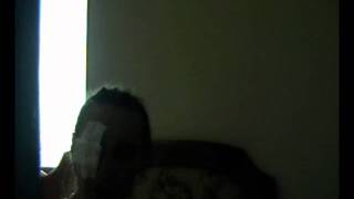 Smash'd, fake eye, drawn on.