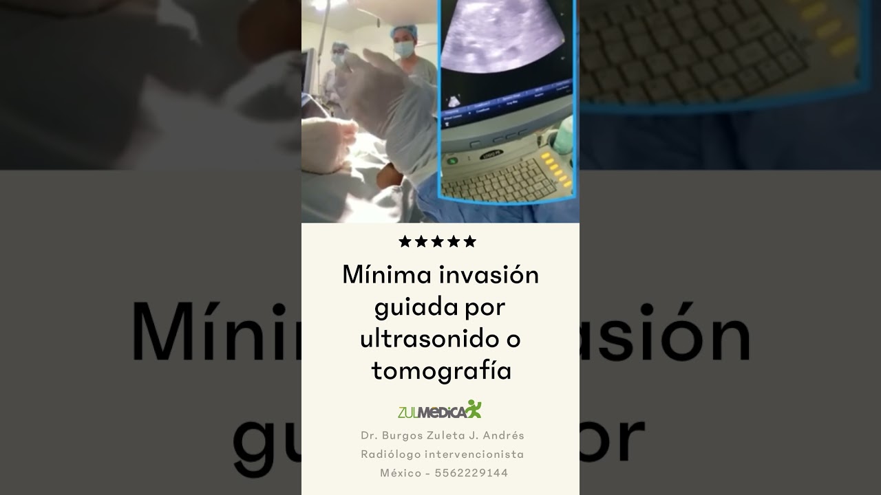 Jose Andres Burgos Zuleta-11