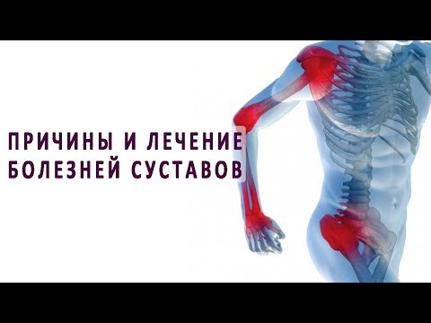Отек сустава голеностопа после перелома Болит локтевой сустав правой руки к кому обращаться