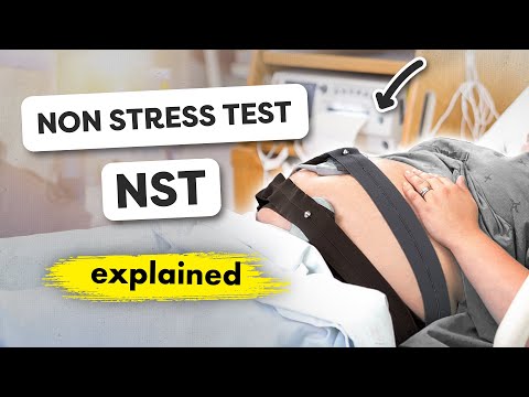 Nonstress Test (NST): Must-Know Insights for Your Baby’s Health