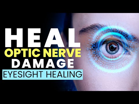 Eyesight Healing Frequency | Heal Optic Nerve Damage | Get Relief from Eye Strain Fast | 528Hz Music