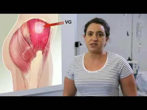 BPG-Injektionsstellen und -methoden