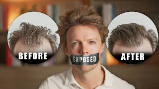 Come smascherare l'industria della caduta dei capelli mi ha aiutato a far ricrescere i miei capel...