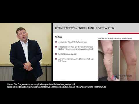 Klinik Vincentinum: Vom Besenreiser bis zur Krampfader