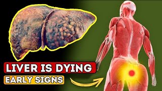 LIVER is DYING! 15 Weird Signs of LIVER DAMAGE