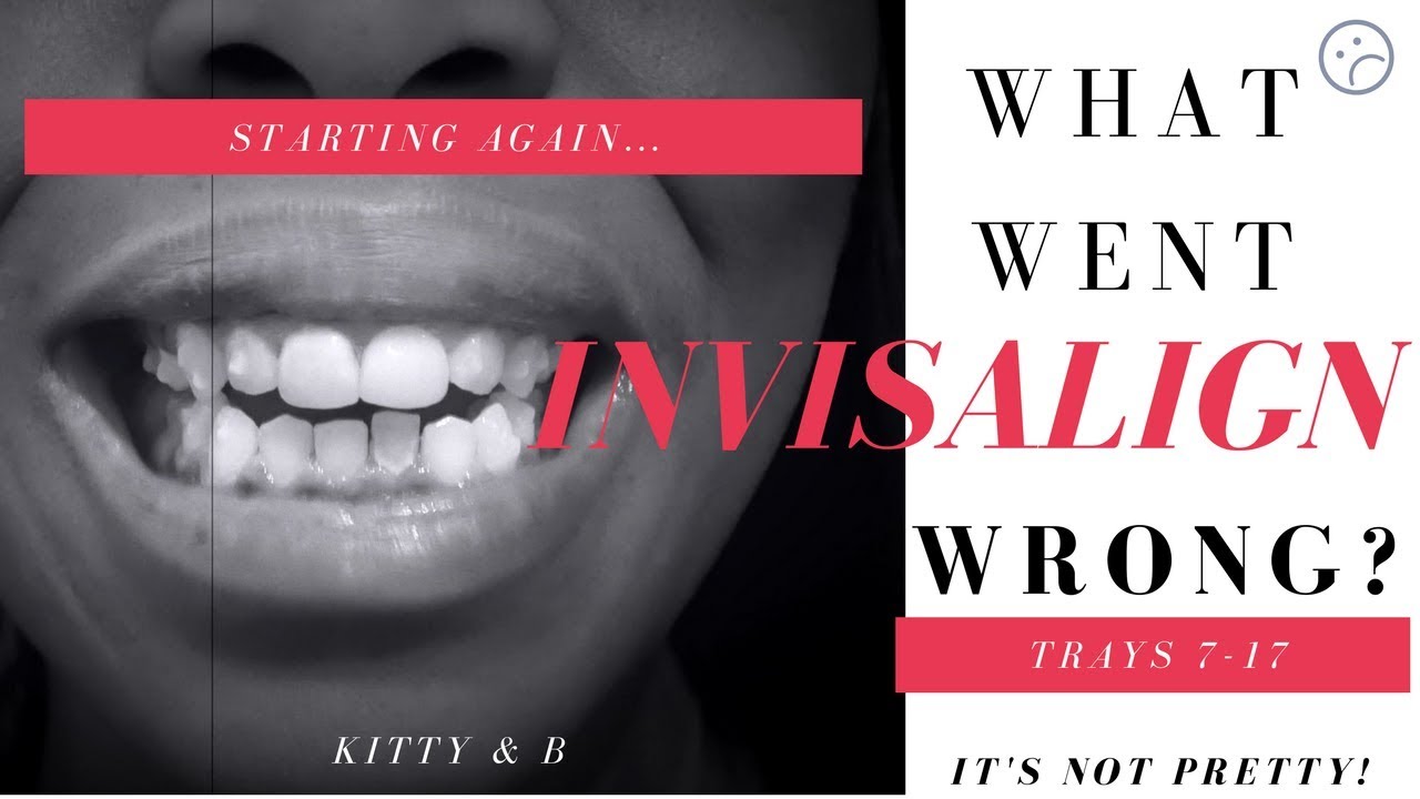 Invisalign what went wrong!| Starting over| IPR | Rescan |Attachments| Progress Trays 7-17 Kitty & B