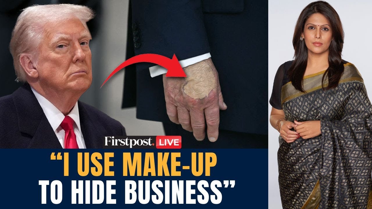 LIVE: Trump Addresses Health Questions After Scrutiny Over Bruising | Vantage with Palki Sharma