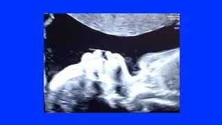 New Life [Lyric Video] - Freedom Fry (2019)