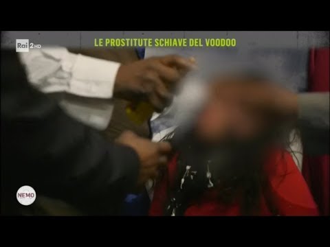 Il pigmentary nota a bambini della ragione La decolorazione e il sollevamento di un pacco di faccia