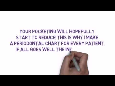 Single Tufted Toothbrushing to reduce gum disease pocketing