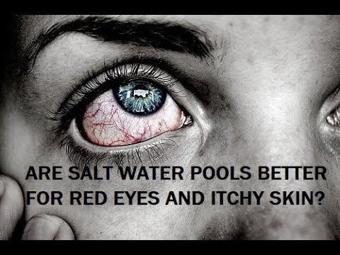 Salt water pools for red eyes and itchy skin