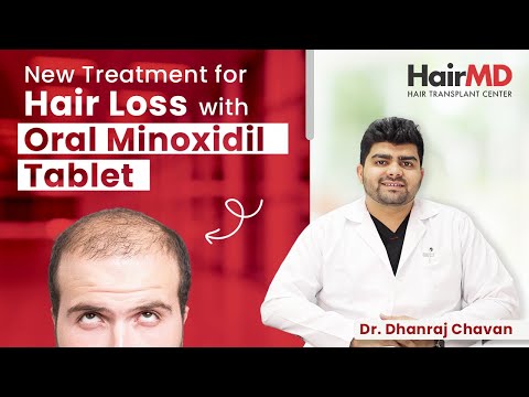 Minoxytop 5mg Tablets