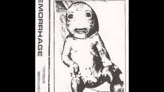 Haemorrhage - Grotesque Embryopathology