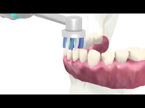 Oral-B - Customer Success Story