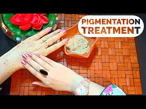 CURE "Pigmentation" & "Freckles" On Face (Tips and Treatment To Remove Pigmentation) Video