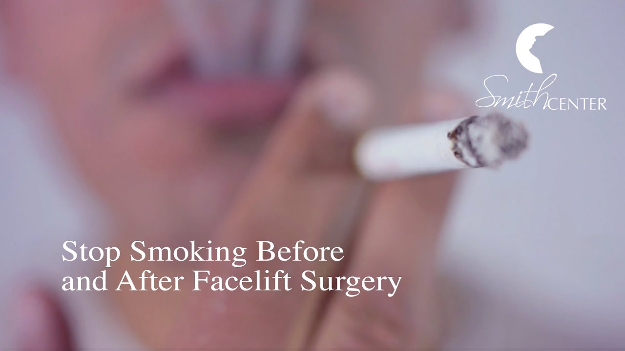 Why Smokers Should Stop Smoking Before and After Facelift Surgery ­- Houston Smith Center