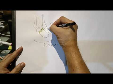 Pathoanatomy of CTEV as basis of its Surgical Correction GKSINGH ERALMCH