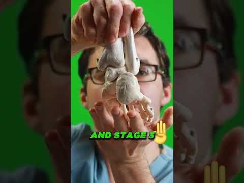 Why Is My Sprained Ankle Still Swollen After 3 6 or 12 MONTHS